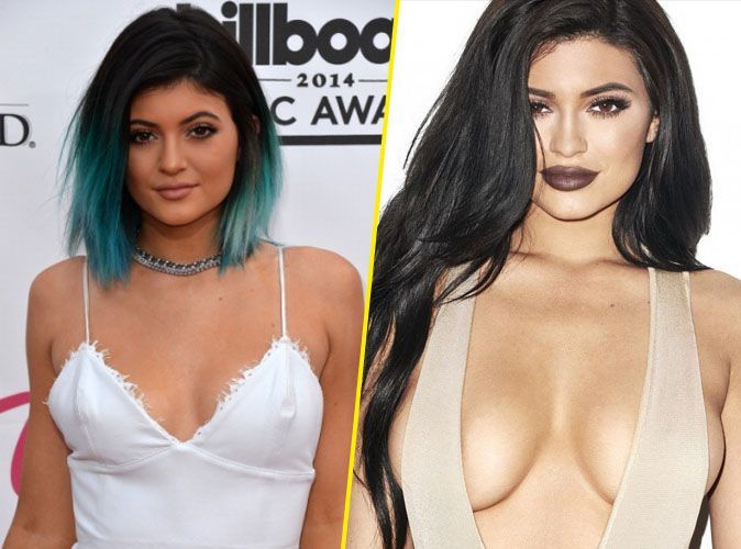 Kylie-Jenner-seins-avant-apres