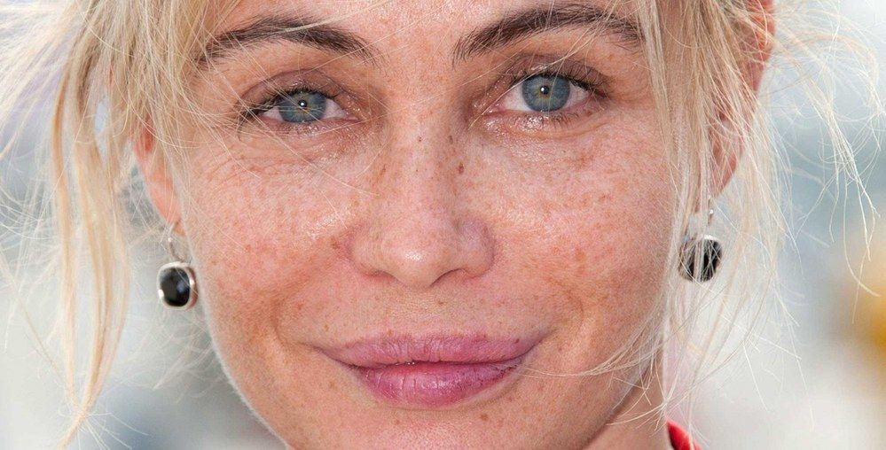 Emmanuelle Béart chirurgie esthétique